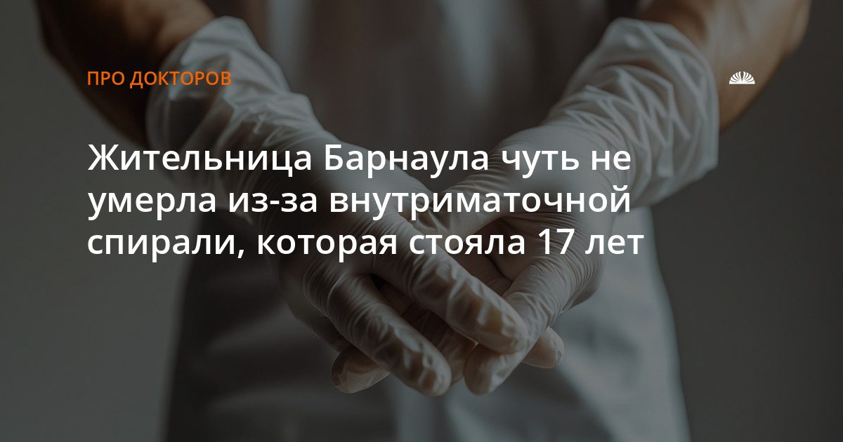 Жительницу Барнаула спасли от перитонита: спираль простояла в ней 17 лет